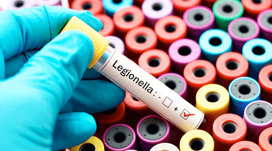 Vial of legionella disease
